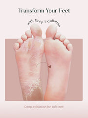 Glycolic Acid Foot Peeling Mask | Exfoliating Foot Peel for Soft, Smooth Skin
